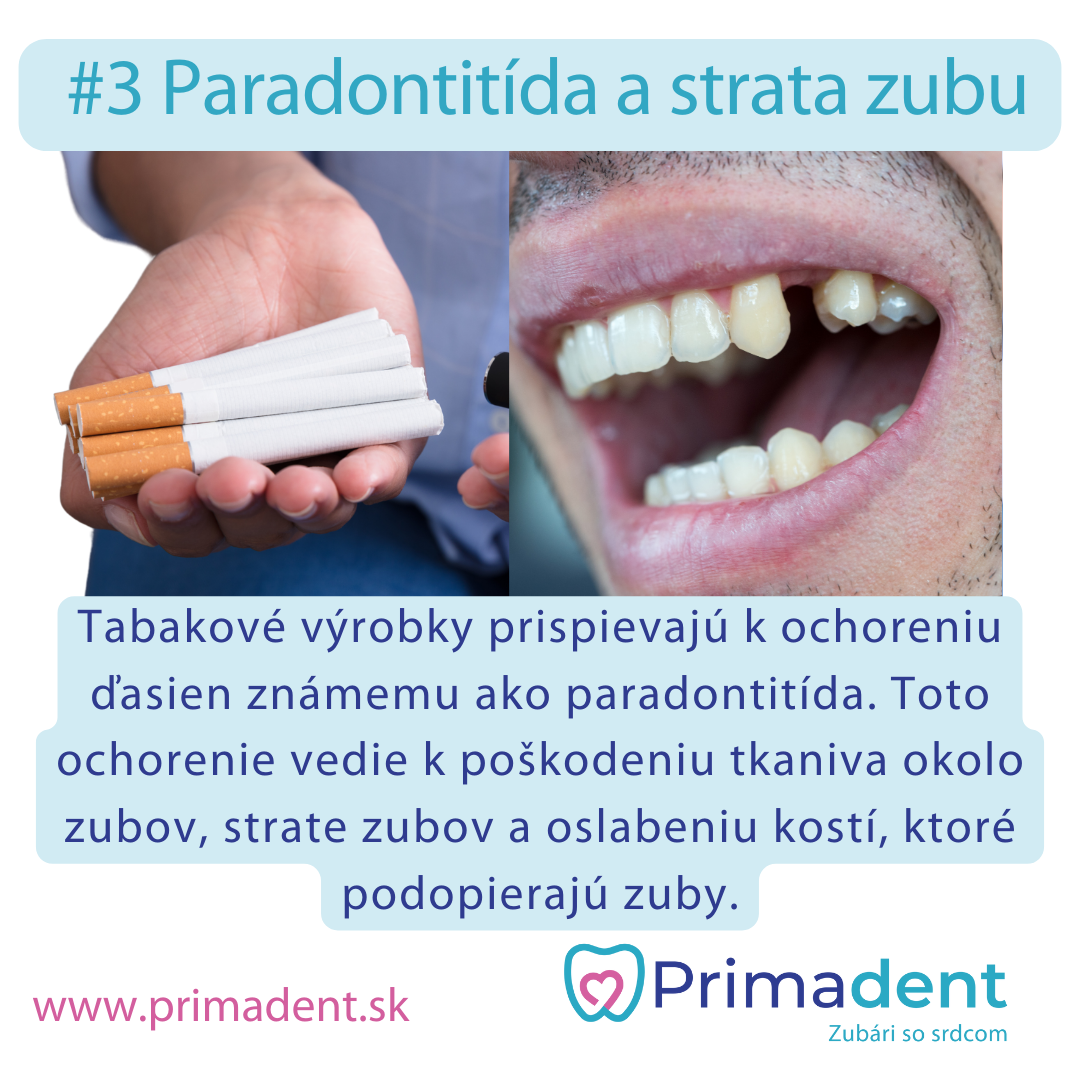 Vplyv fajčenia na zuby